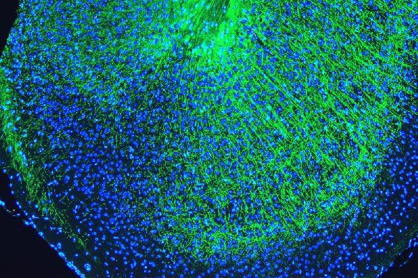 MBP Antibody in Immunohistochemistry (Paraffin) (IHC (P))