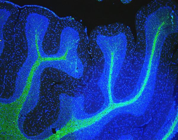 MBP Antibody in Immunohistochemistry (Paraffin) (IHC (P))