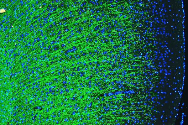 MBP Antibody in Immunohistochemistry (Paraffin) (IHC (P))