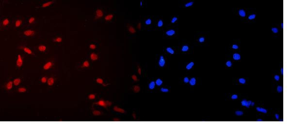 MCM2 Antibody in Immunocytochemistry (ICC/IF)