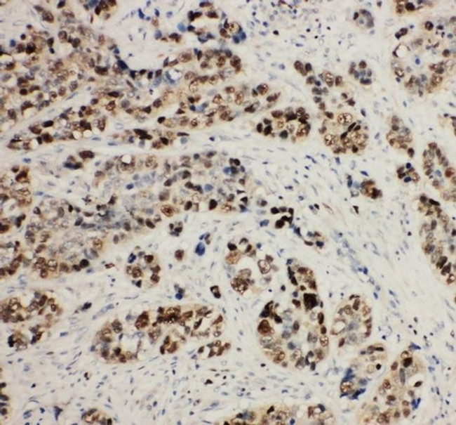 MCM2 Antibody in Immunohistochemistry (Paraffin) (IHC (P))