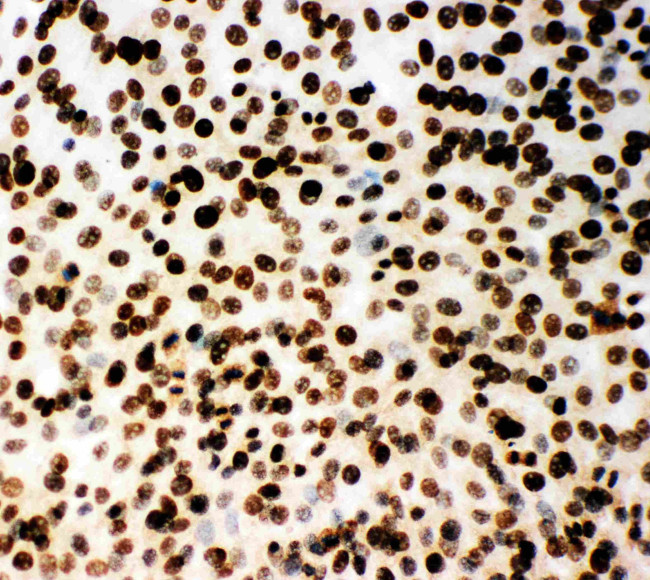 MCM2 Antibody in Immunocytochemistry (ICC/IF)