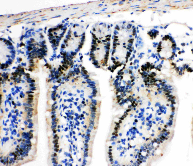 MCM2 Antibody in Immunohistochemistry (Paraffin) (IHC (P))