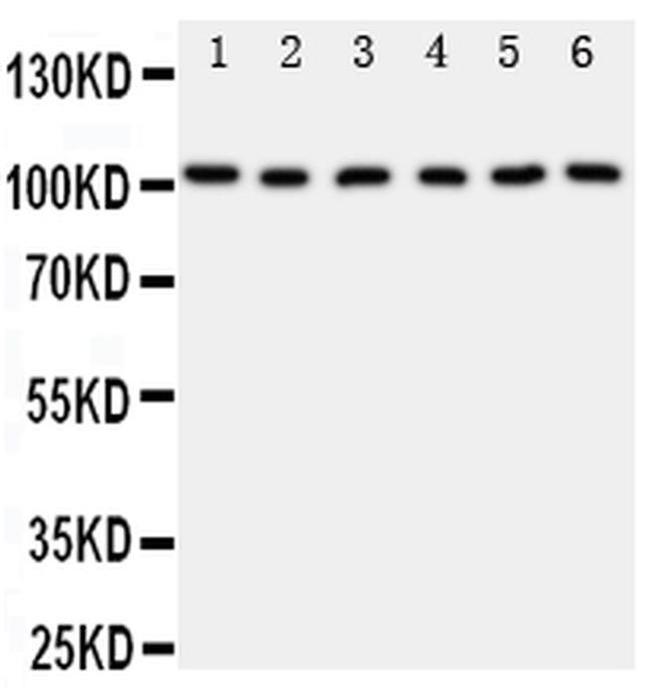 MCM2 Antibody in Western Blot (WB)