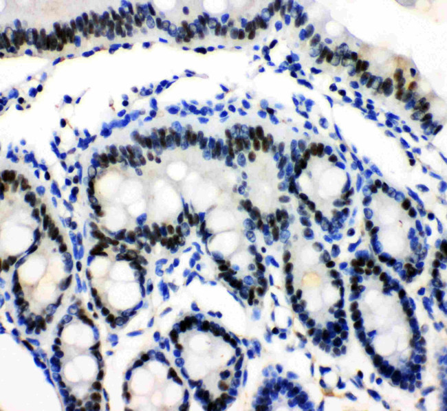 MCM3 Antibody in Immunohistochemistry (Paraffin) (IHC (P))