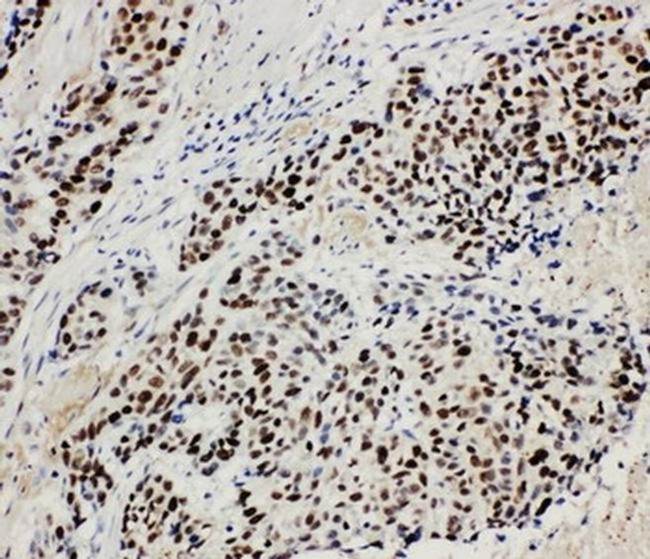 MCM3 Antibody in Immunohistochemistry (Paraffin) (IHC (P))