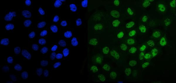 MCM6 Antibody in Immunocytochemistry (ICC/IF)