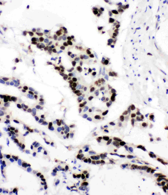 MCM6 Antibody in Immunohistochemistry (Paraffin) (IHC (P))