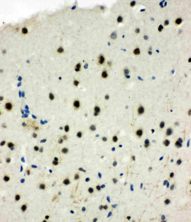 MCM6 Antibody in Immunohistochemistry (Paraffin) (IHC (P))