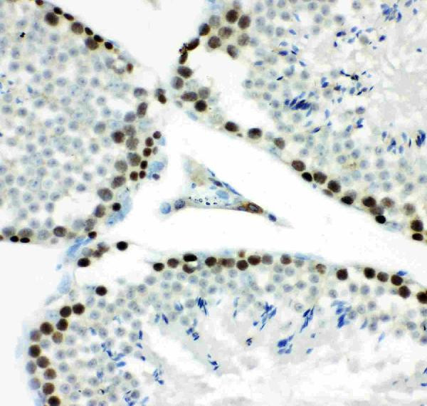 MCM7 Antibody in Immunohistochemistry (Paraffin) (IHC (P))