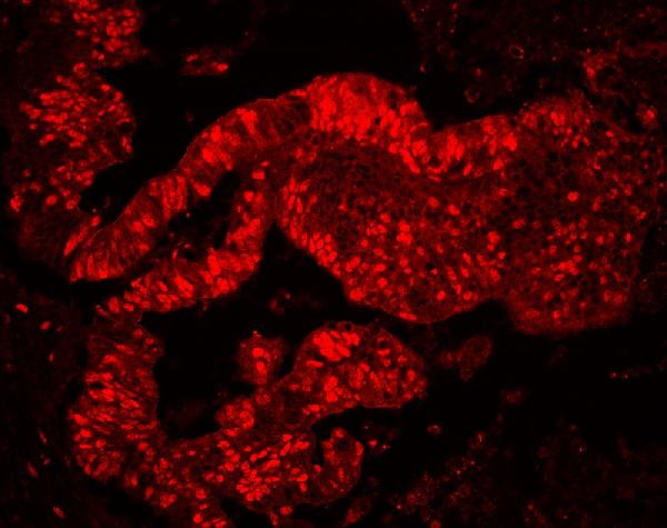 MCM7 Antibody in Immunohistochemistry (Paraffin) (IHC (P))