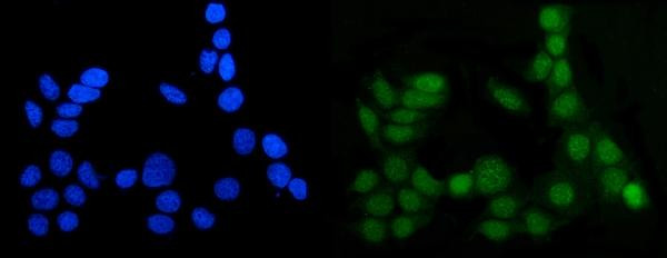 MGMT Antibody in Immunocytochemistry (ICC/IF)