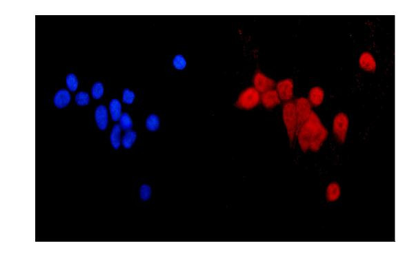 MGMT Antibody in Immunocytochemistry (ICC/IF)