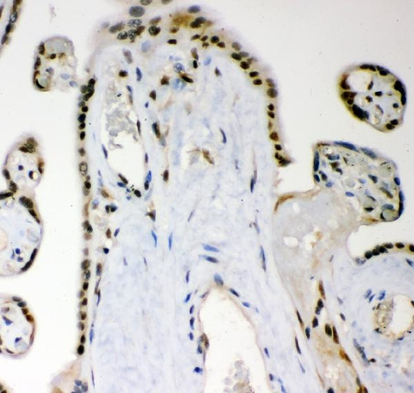 MGMT Antibody in Immunohistochemistry (Paraffin) (IHC (P))