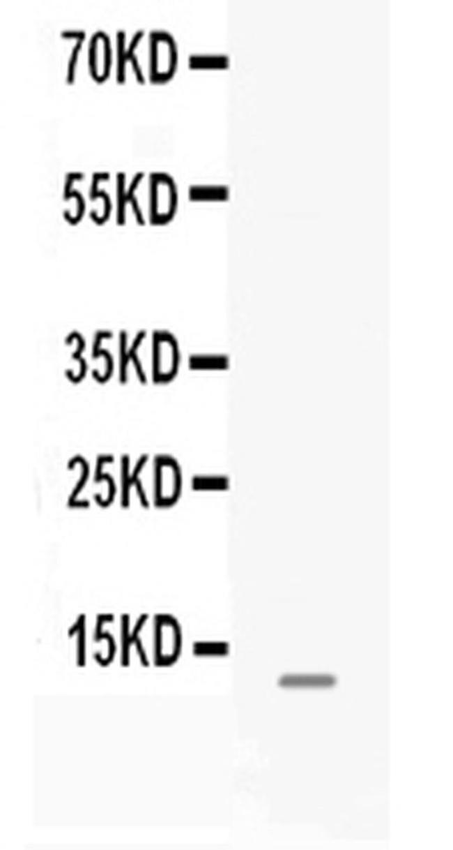 MGP Antibody in Western Blot (WB)