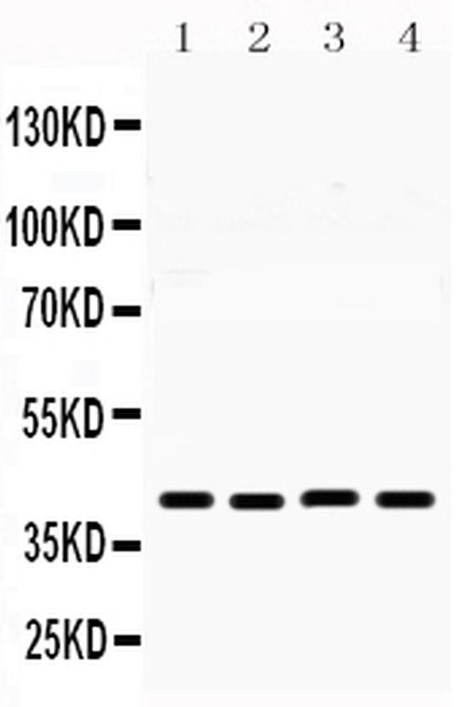 MICB Antibody in Western Blot (WB)