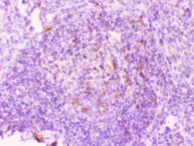 MMP11 Antibody in Immunohistochemistry (Paraffin) (IHC (P))