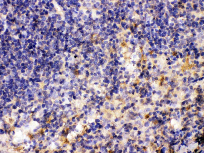 MMP11 Antibody in Immunohistochemistry (Paraffin) (IHC (P))