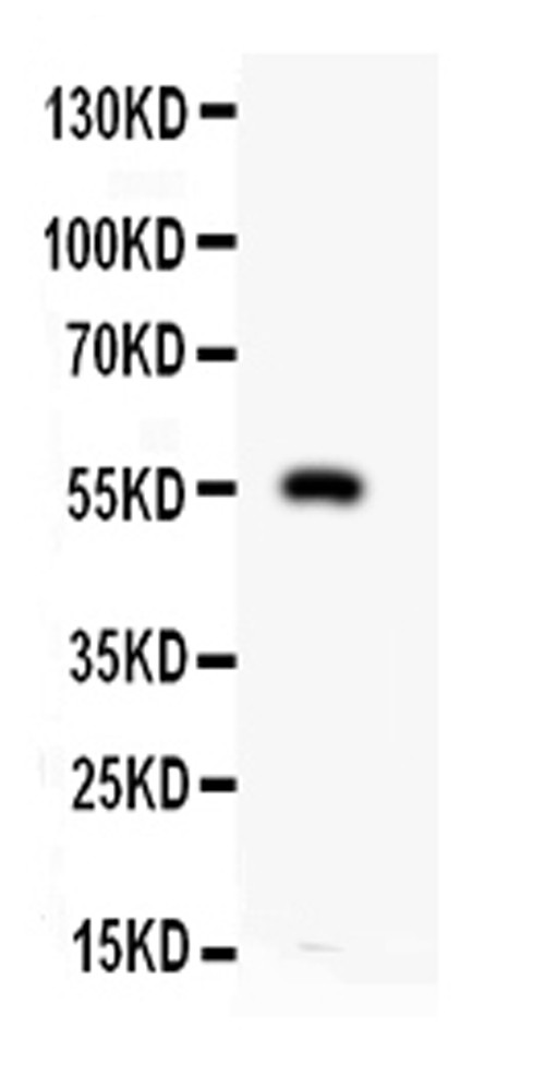 MMP12 Antibody in Western Blot (WB)