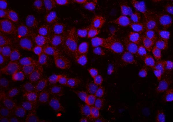 MMP16 Antibody in Immunocytochemistry (ICC/IF)