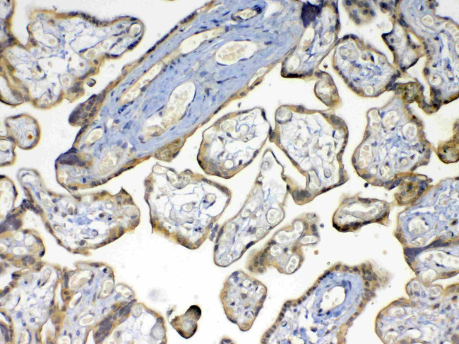 MMP16 Antibody in Immunohistochemistry (Paraffin) (IHC (P))