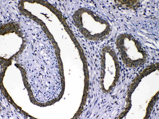 MMP16 Antibody in Immunohistochemistry (Paraffin) (IHC (P))