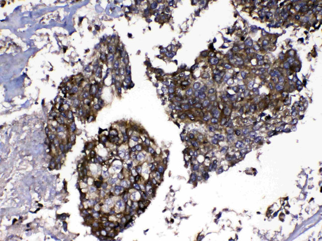 MMP16 Antibody in Immunohistochemistry (Paraffin) (IHC (P))