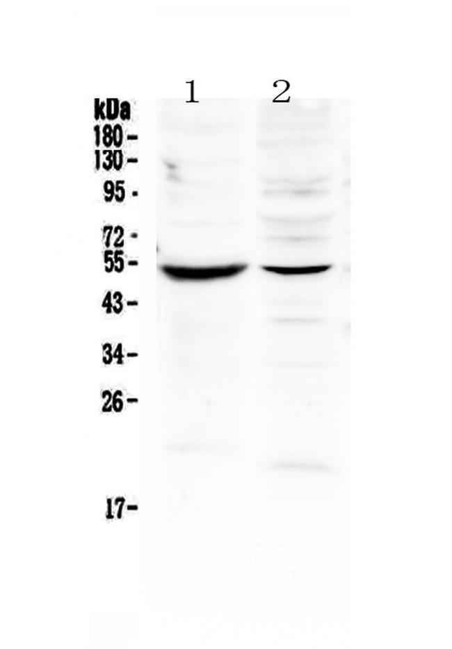 MMP16 Antibody in Western Blot (WB)