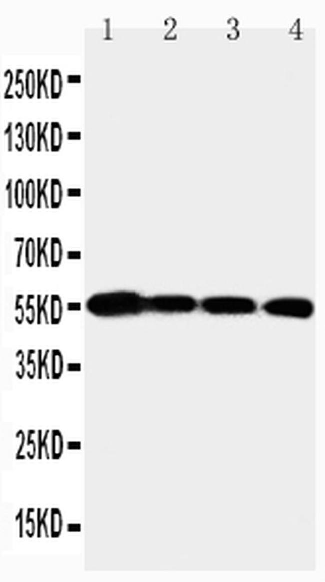 MMP24 Antibody in Western Blot (WB)