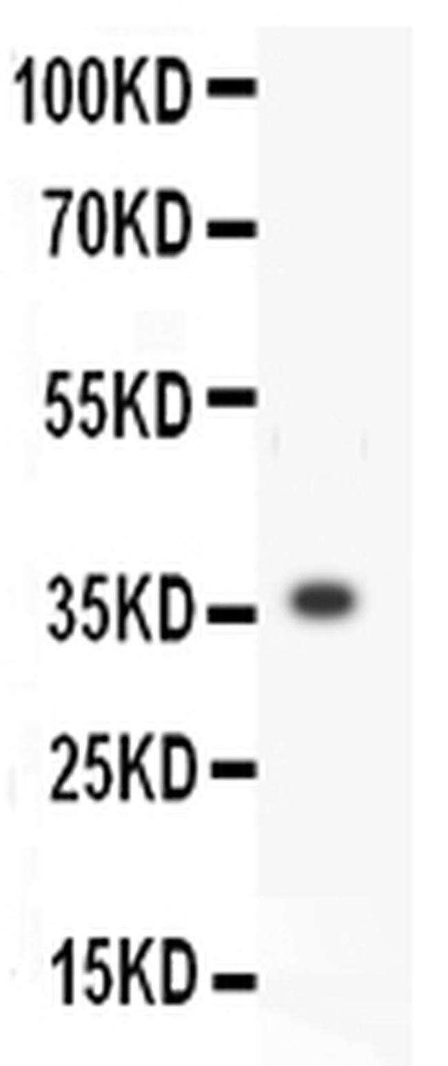 MMP3 Antibody in Western Blot (WB)