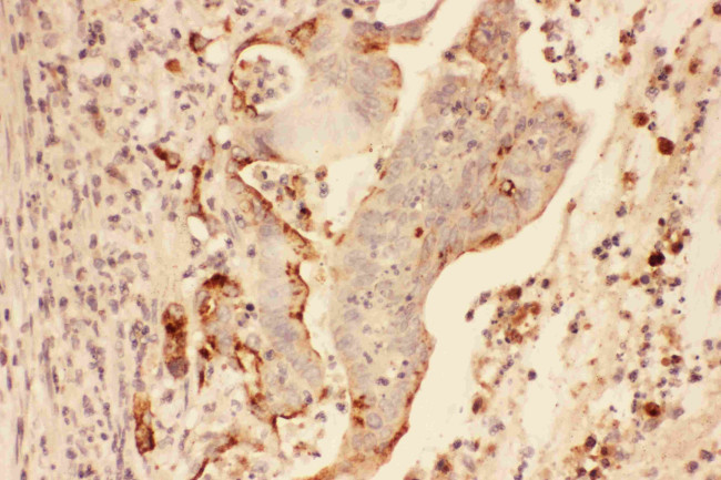 MMP7 Antibody in Immunohistochemistry (Paraffin) (IHC (P))