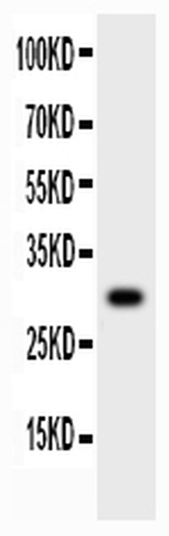 MMP7 Antibody in Western Blot (WB)