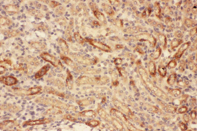 MMP7 Antibody in Immunohistochemistry (Paraffin) (IHC (P))