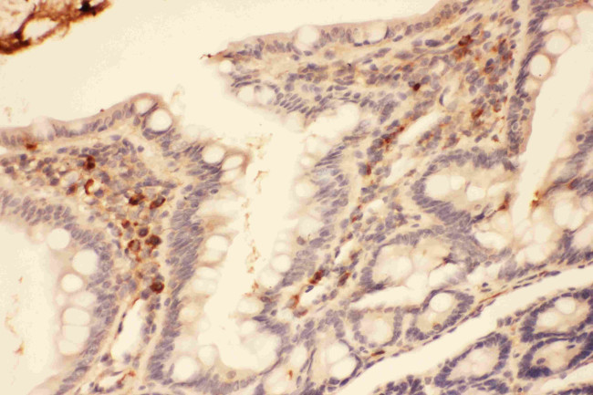 MMP7 Antibody in Immunohistochemistry (Paraffin) (IHC (P))