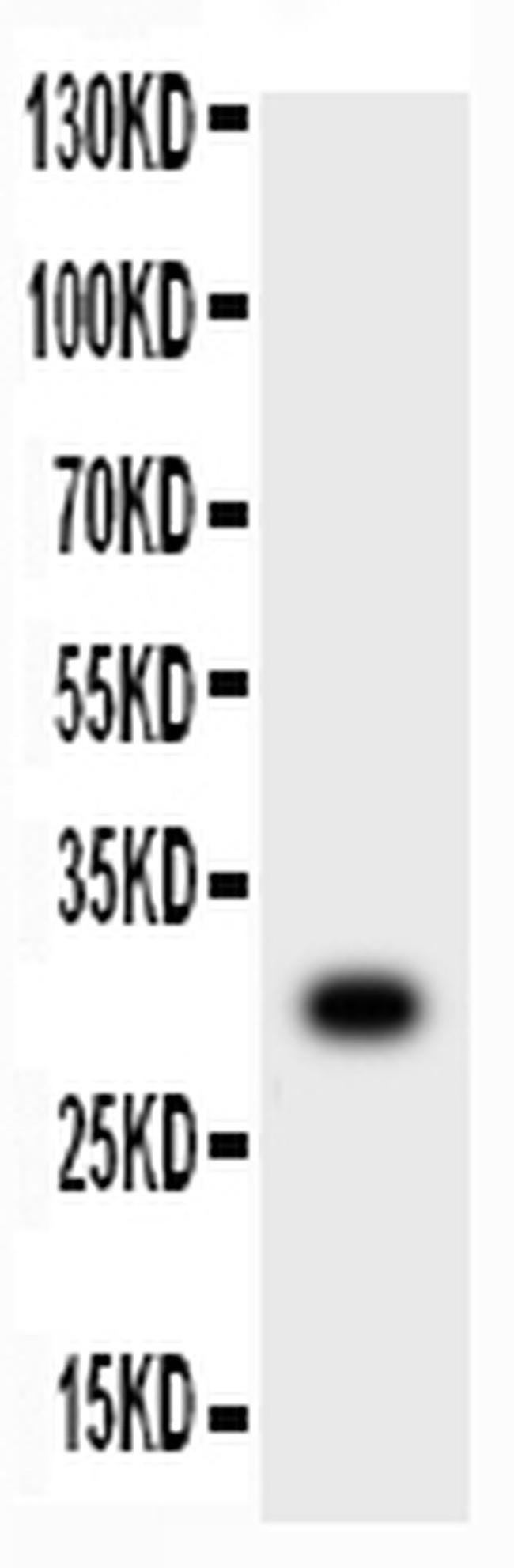 MMP7 Antibody in Western Blot (WB)