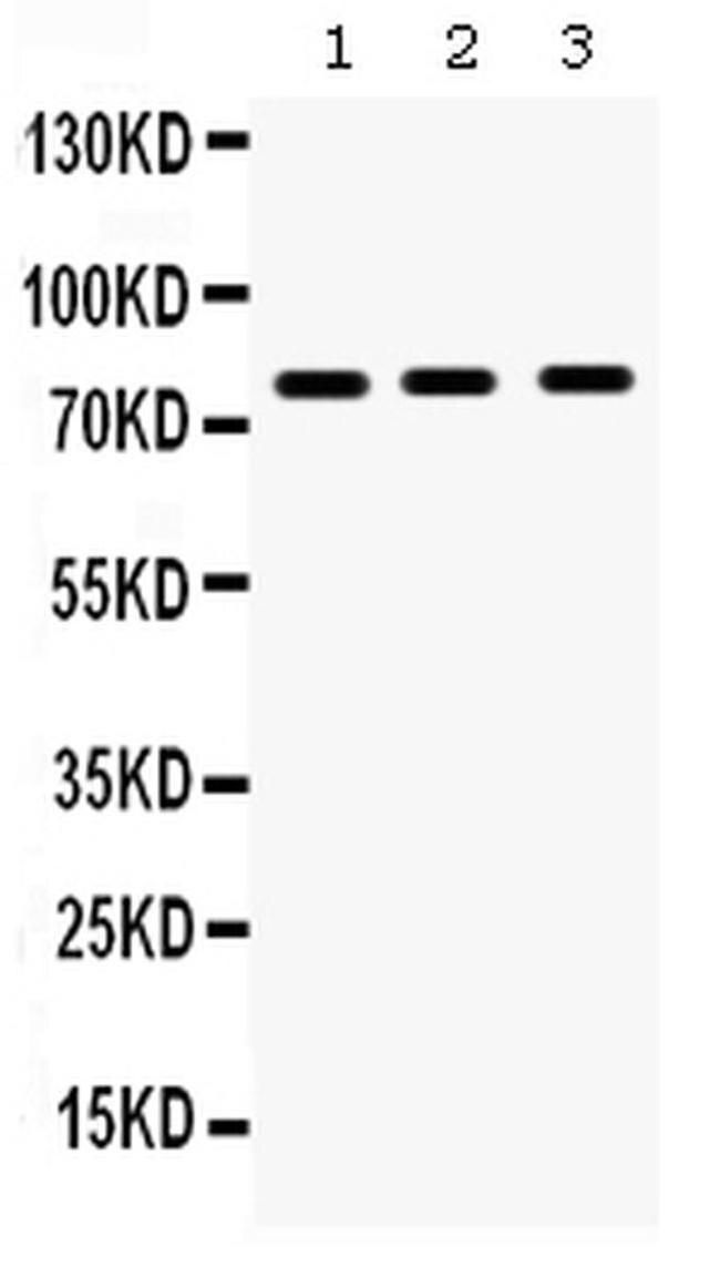 MMP9 Antibody in Western Blot (WB)