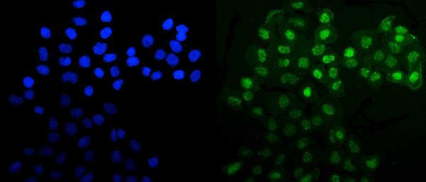 MNAT1 Antibody in Immunocytochemistry (ICC/IF)