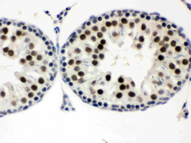 MNAT1 Antibody in Immunohistochemistry (Paraffin) (IHC (P))