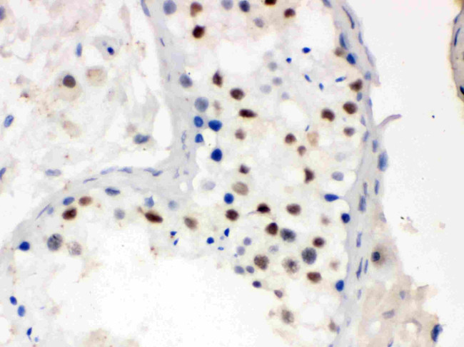 MNAT1 Antibody in Immunohistochemistry (Paraffin) (IHC (P))