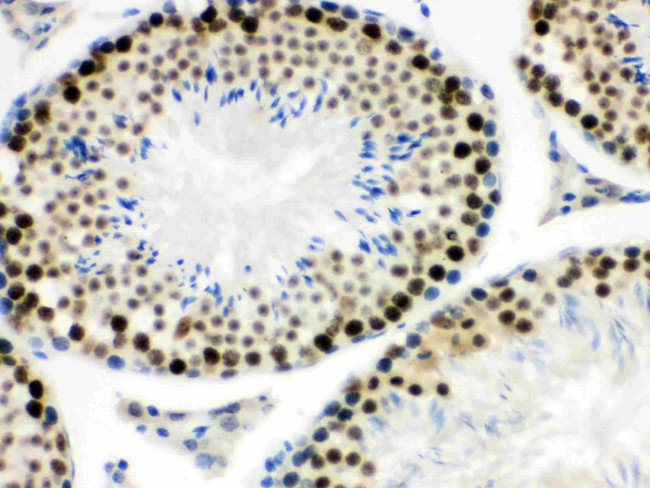 MNAT1 Antibody in Immunohistochemistry (Paraffin) (IHC (P))