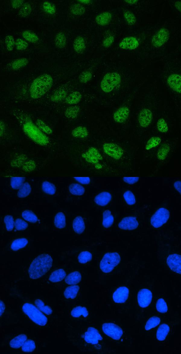 MSH2 Antibody in Immunocytochemistry (ICC/IF)