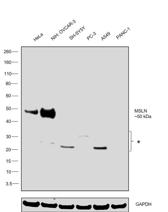 Mesothelin Antibody in Western Blot (WB)