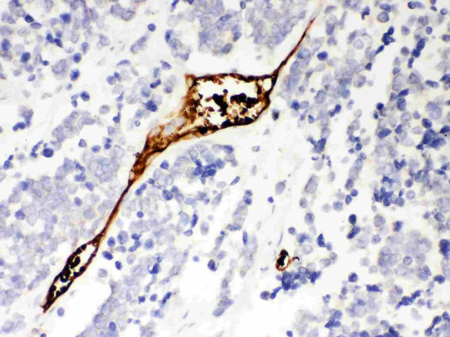 Mesothelin Antibody in Immunohistochemistry (Paraffin) (IHC (P))