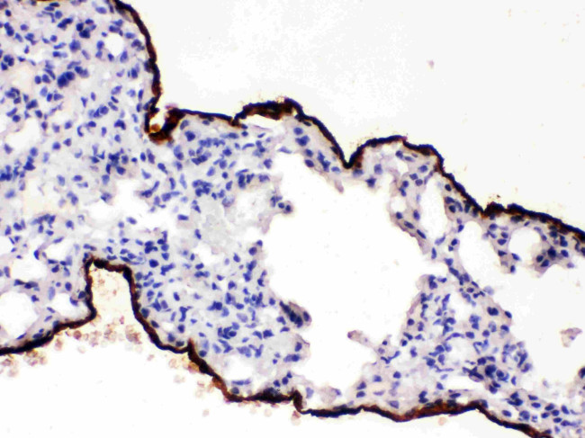 Mesothelin Antibody in Immunohistochemistry (Paraffin) (IHC (P))