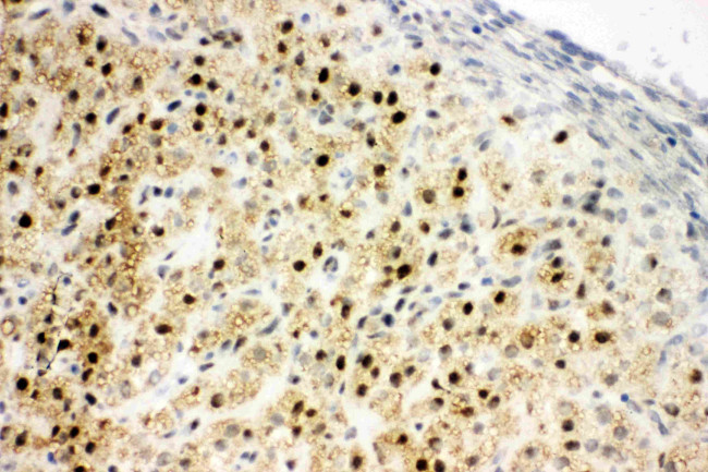 MTA1 Antibody in Immunohistochemistry (Frozen) (IHC (F))