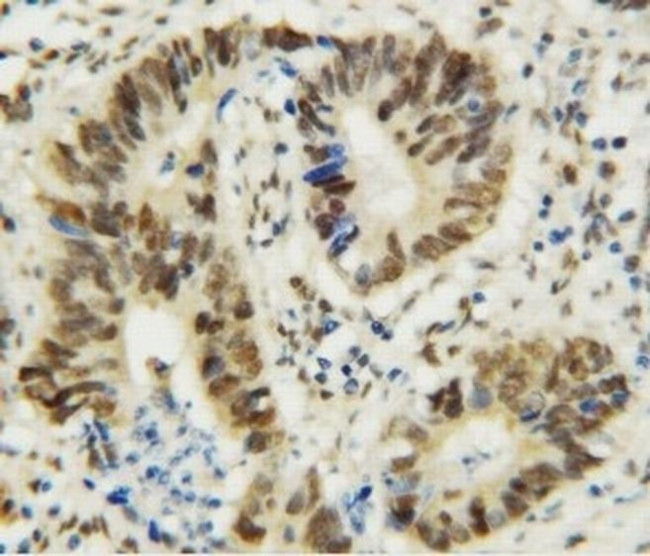 MTA1 Antibody in Immunohistochemistry (Paraffin) (IHC (P))