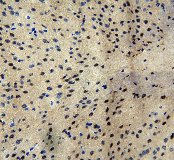 MTA1 Antibody in Immunohistochemistry (Frozen) (IHC (F))