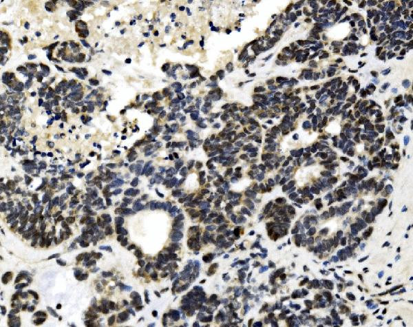 MTA1 Antibody in Immunohistochemistry (Paraffin) (IHC (P))