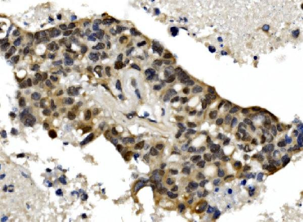 MTA1 Antibody in Immunohistochemistry (Paraffin) (IHC (P))