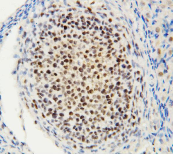 MTA1 Antibody in Immunohistochemistry (Paraffin) (IHC (P))